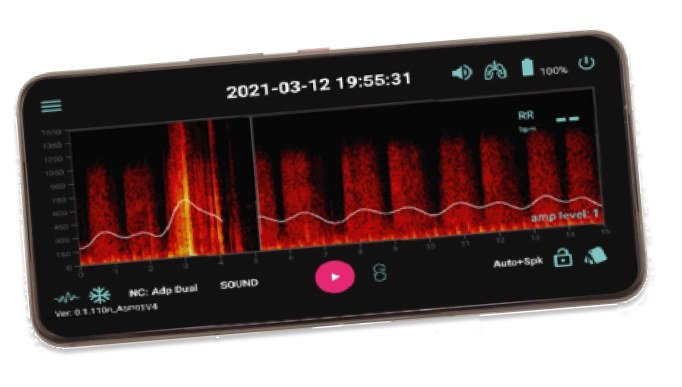 a.Noise-Resilient Monitoring: Advanced noise reduction ensures accurate detection in clinical settings b.Patient-Specific Customization: Adjustable AI parameters for adults and children c.Flexible Alert System: Customizable alarm settings for diverse clinical needs