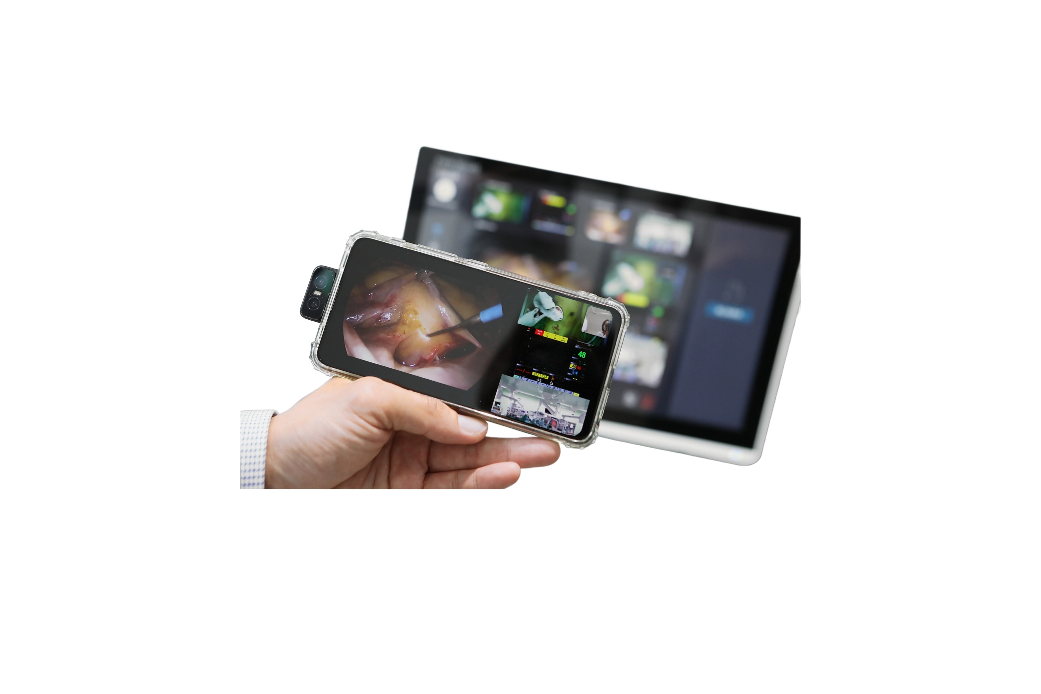 Remote Surgery Collaboration Platform