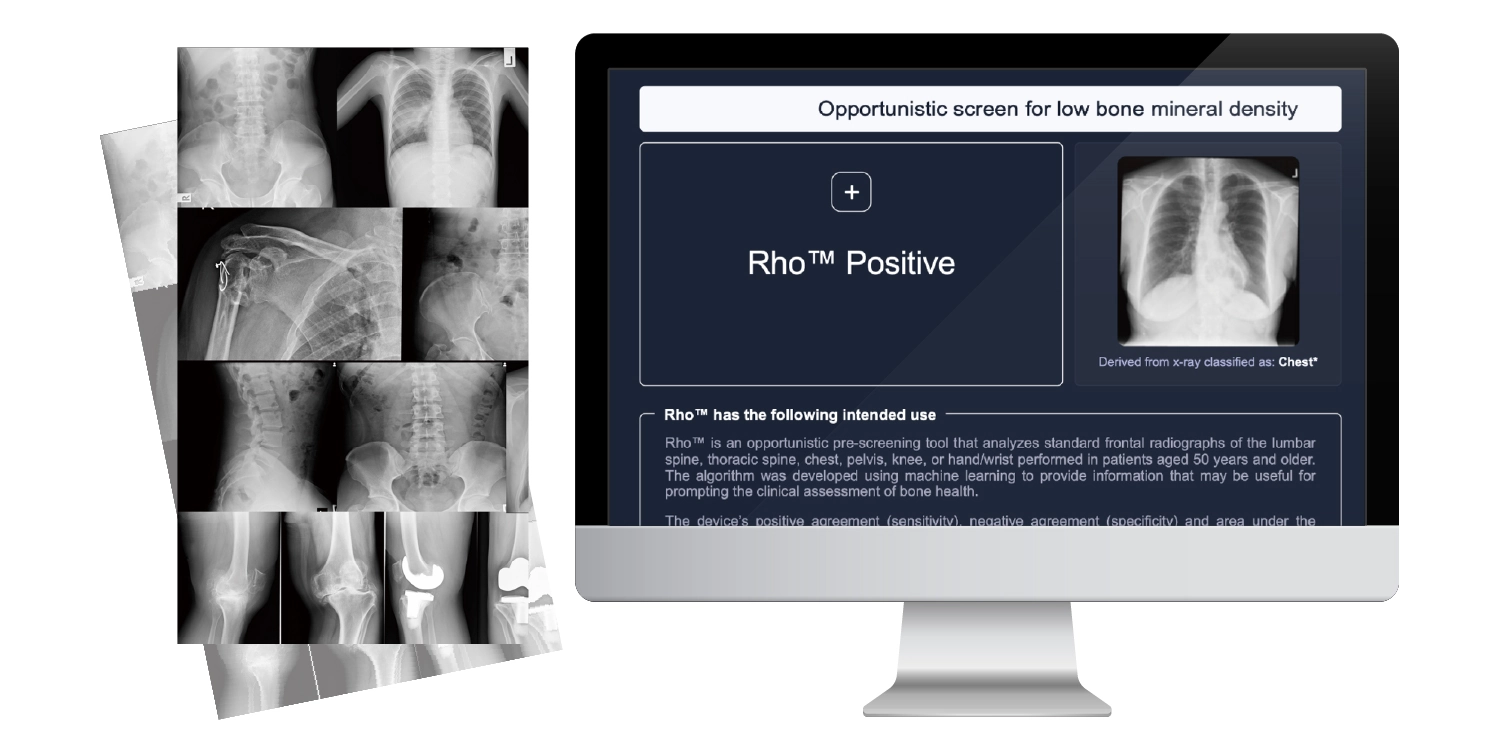 Low-Dose Portable Fluoro-Radiography (Hybrid)